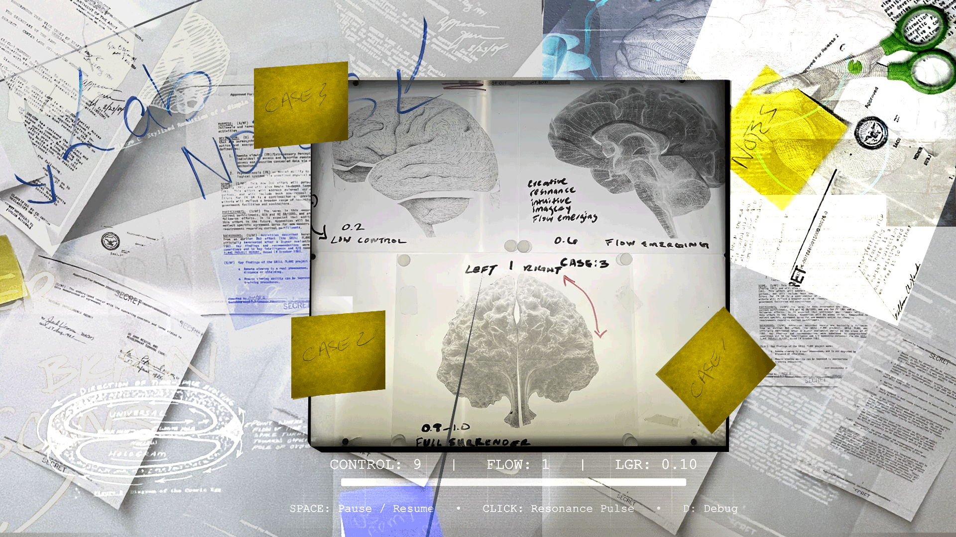 CIA Brain Scans Light box & CIA Psychologist Notes